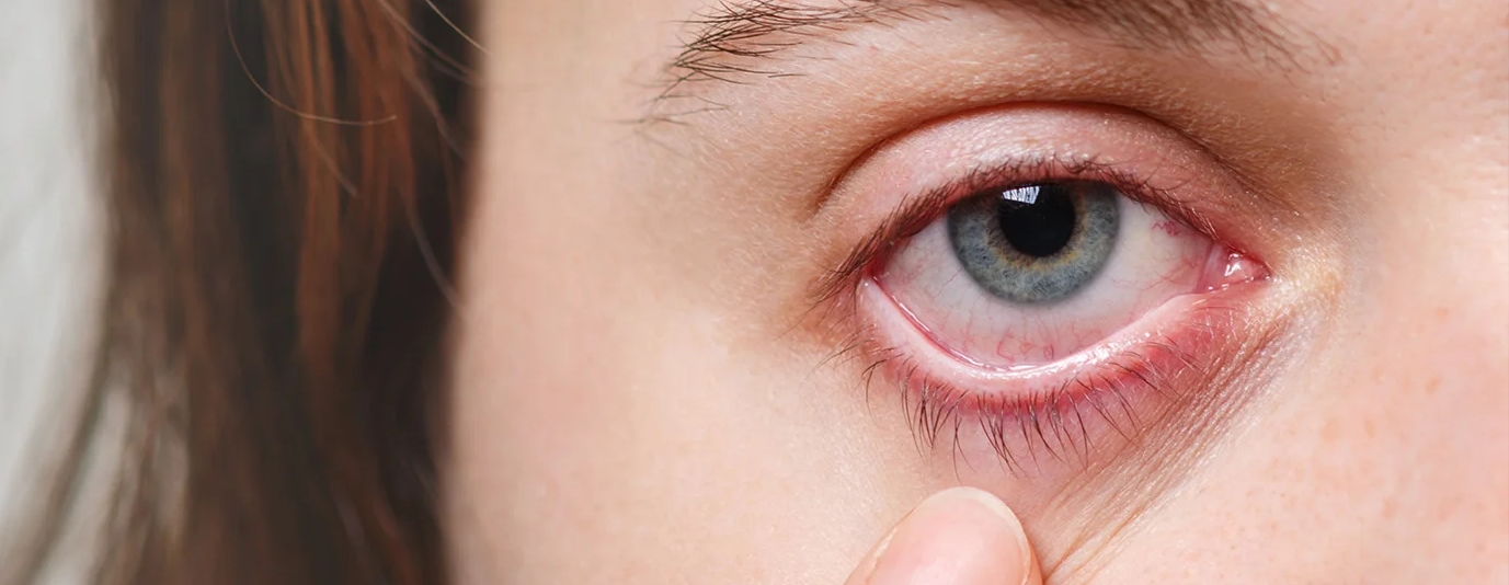 eye specialist in Kota dr ankur gupta 3